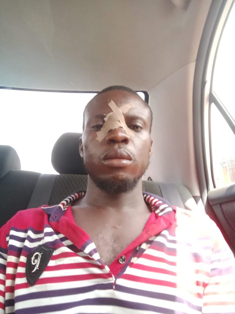 Aftermath of 2023 General Election: Monday Boi runs for dear life